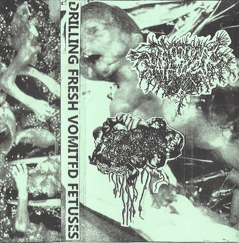 Fermented Anal Urine Of Fecal Splattere Vomit Larvae Of Infected Vaginal Pus Made Of Liquid Fetus Di : Drilling Fresh Vomited Fetuses